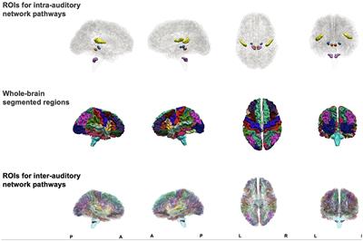Reduced white matter maturation in the central auditory system of children living with HIV